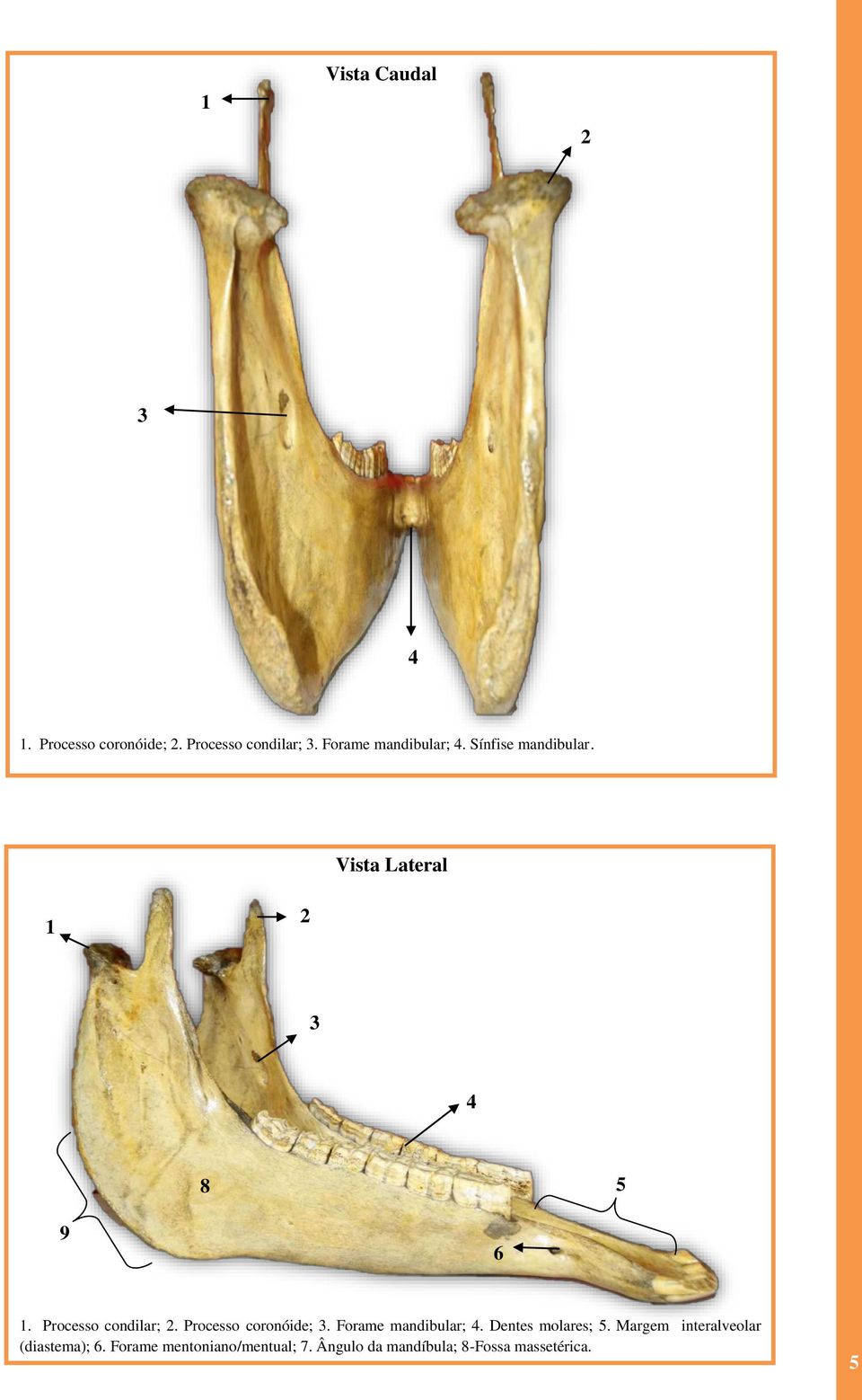 Processo coronóide;. Forame mandibular;. Dentes molares;.