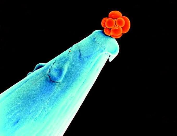 Embrião humano na ponta de uma agulha