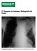 7º Imagem da Semana: Radiografia de Tórax