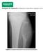 Imagem da Semana: Radiografia e Ressonância Magnética (RM)