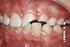 2ª. PARTE CONHECIMENTOS ESPECÍFICOS. 21. A dentina do manto e a dentina circum pulpar constituem a dentina: