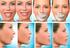 Trauma Maxilo - Facial. Importância da Face - Funções vitais - Terminal de quatro sentidos - Expressão facial - Elo de expressão
