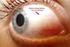 Anatomia e embriologia do olho